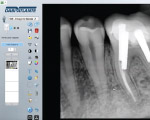 Video 03